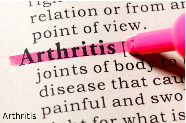 Arthritis- senior tips for Exercising